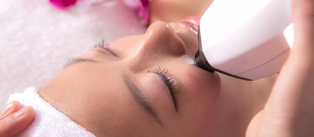 إزالة الشعر بالليزر