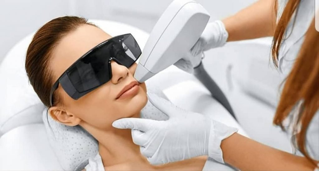 إزالة الشعر بالليزر